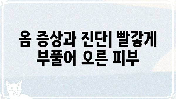 옴전염 예방과 관리| 증상, 원인, 치료법 | 옴, 기생충, 피부 질환, 전염병